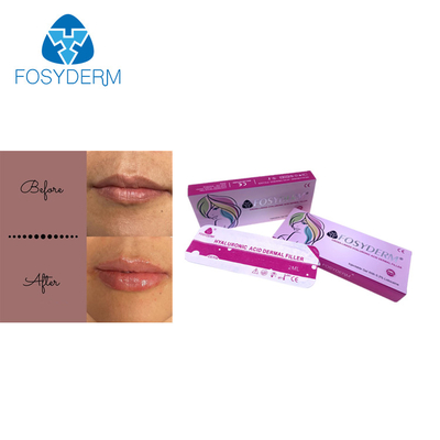 Linea acida ialuronica di Derm dell'iniezione di potenziamento del labbro dei riempitori cutanei del labbro di Fosyderm 2ml